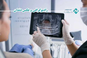رادیوگرافی و عکس دندان