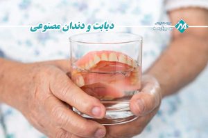 دیابت و دندان مصنوعی