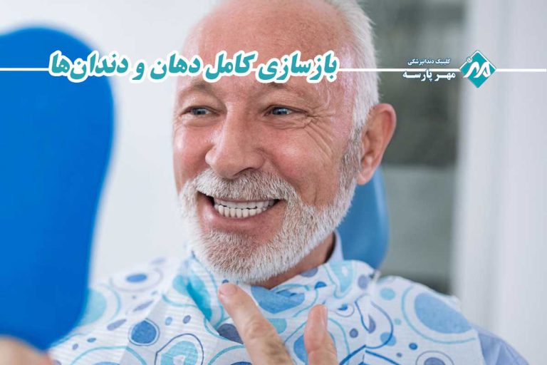 بازسازی کامل دهان و دندانها