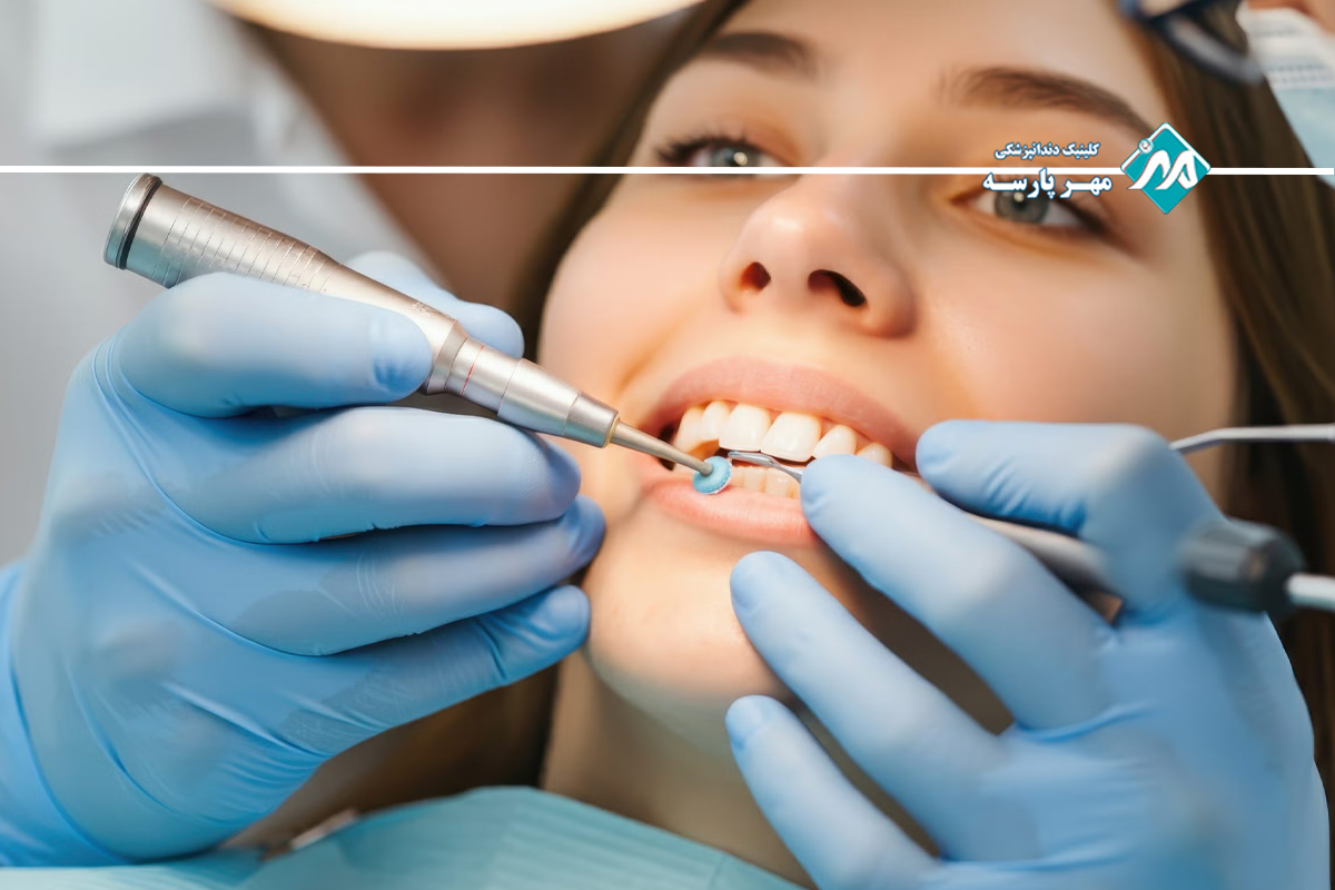 کاندیدای ایده آل برای کامپوزیت دندان