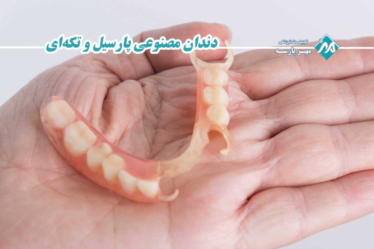 دندان مصنوعی پارسیل و تکهای