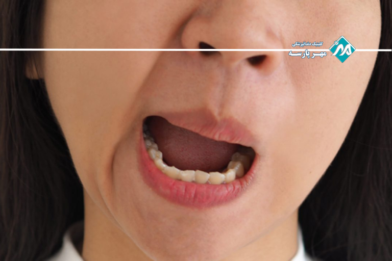 مشکلات فک روی صحبت کردن