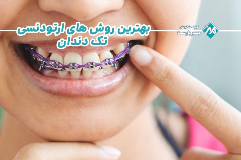 ارتودنسی تک دندان