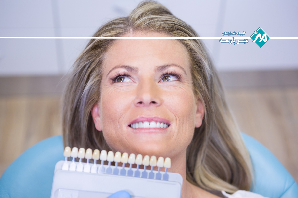 کاندیدای مناسب برای لمینت دندان در غرب تهران