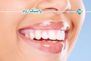 وایتینگ زوم دندان