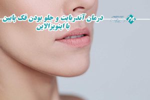 درمان آندربایت و جلو بودن فک پایین با اینویزالاین