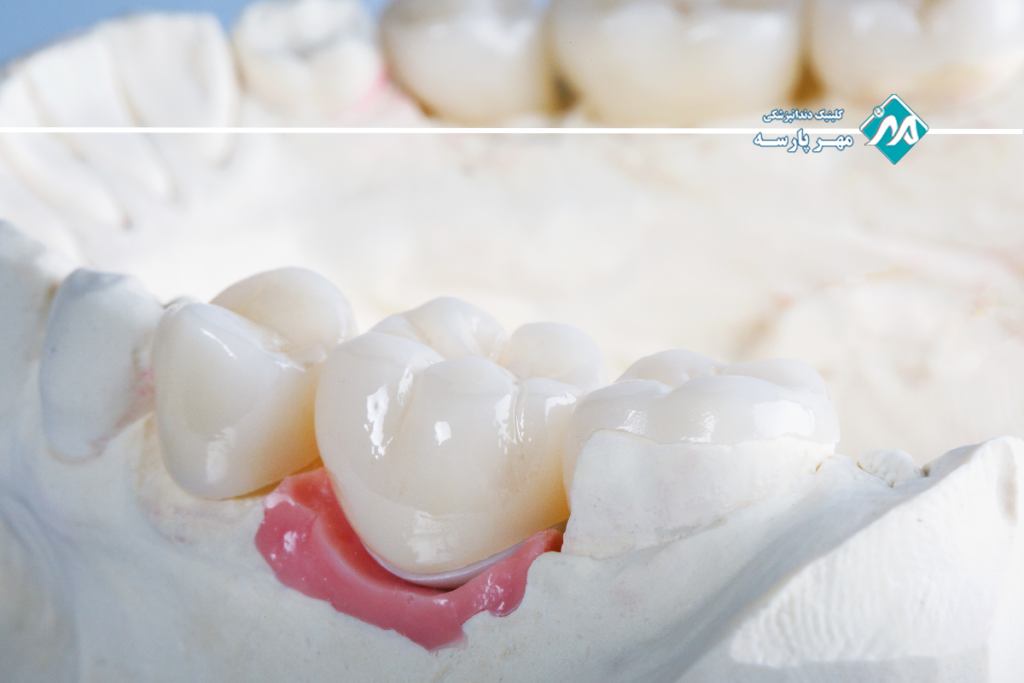 منظور از افزایش طول تاج چیست؟