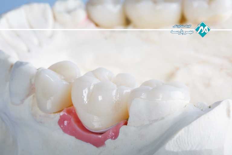 منظور از افزایش طول تاج چیست؟