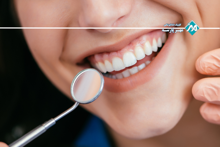 منظور از دندان خرگوشی چیست؟