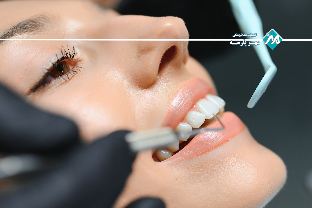 درمان‌ های دندانپزشکی زیبایی