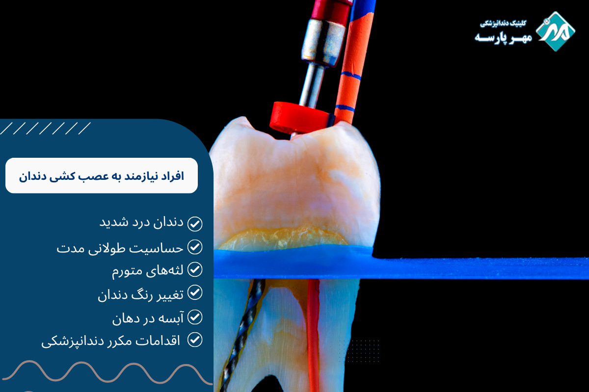 عصب کشی در غرب تهران