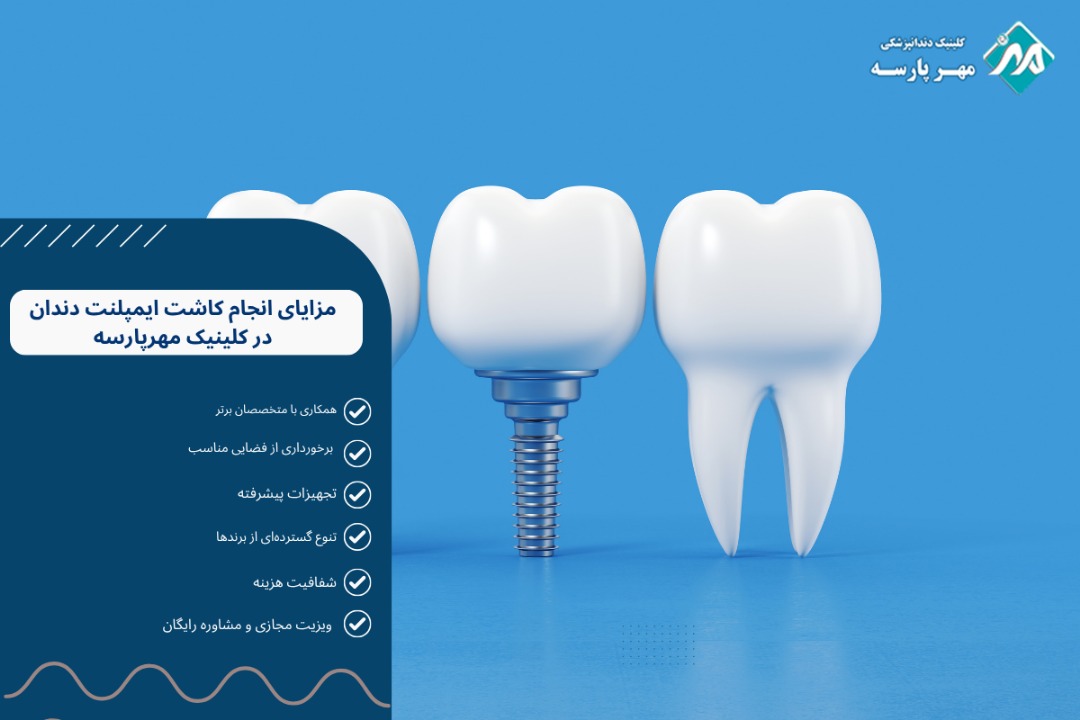 مزایای انجام کاشت ایمپلنت دندان در کلینیک مهرپارسه