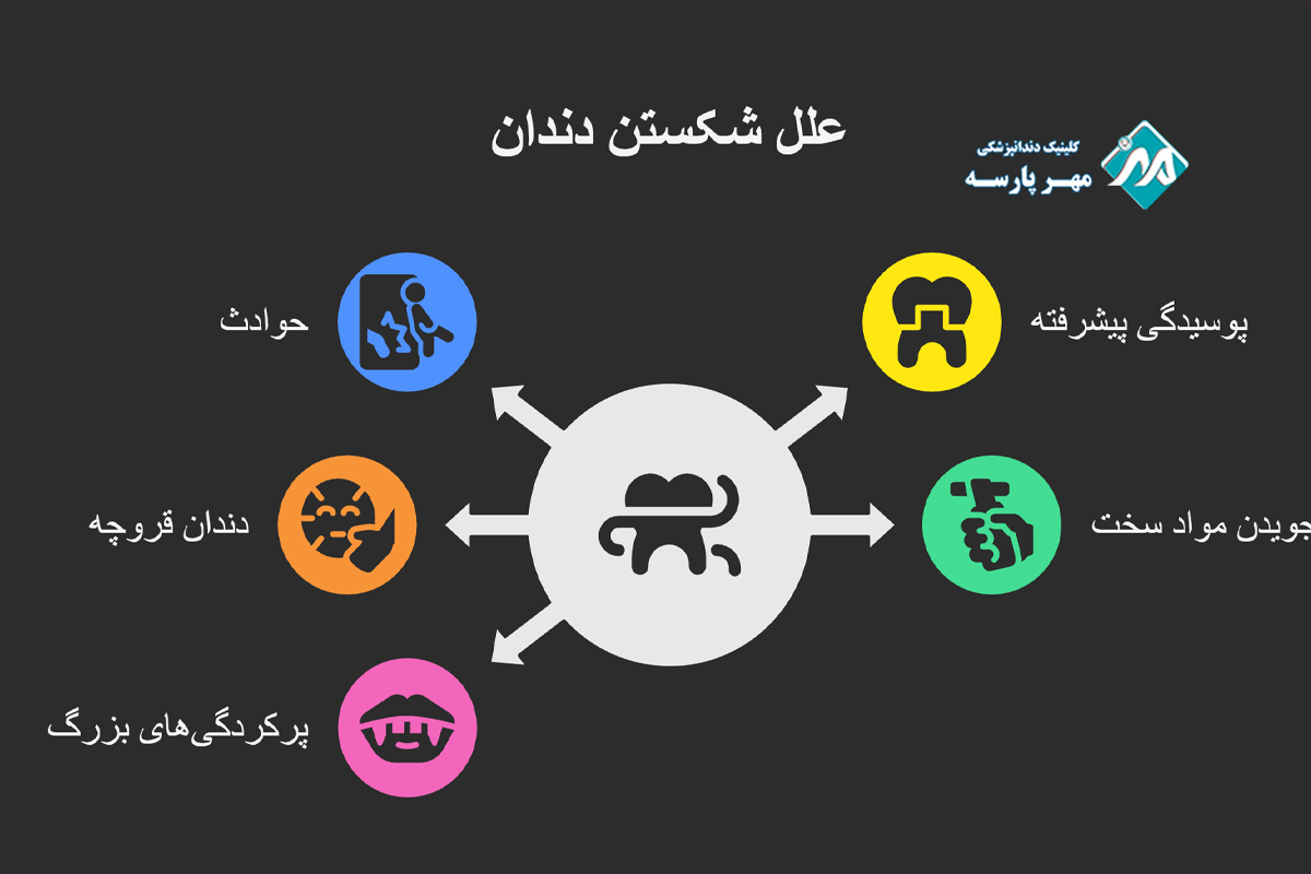 علل رایج شکستن دندان