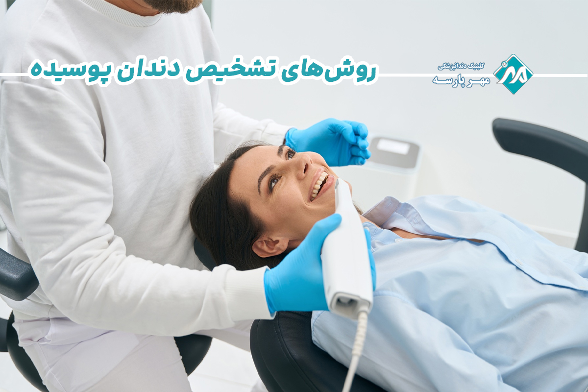 روش‌های تشخیص دندان پوسیده 