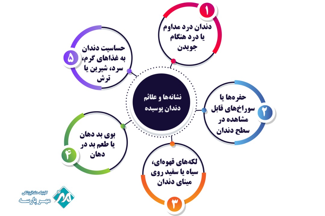 نشانه‌ها و علائم دندان پوسیده