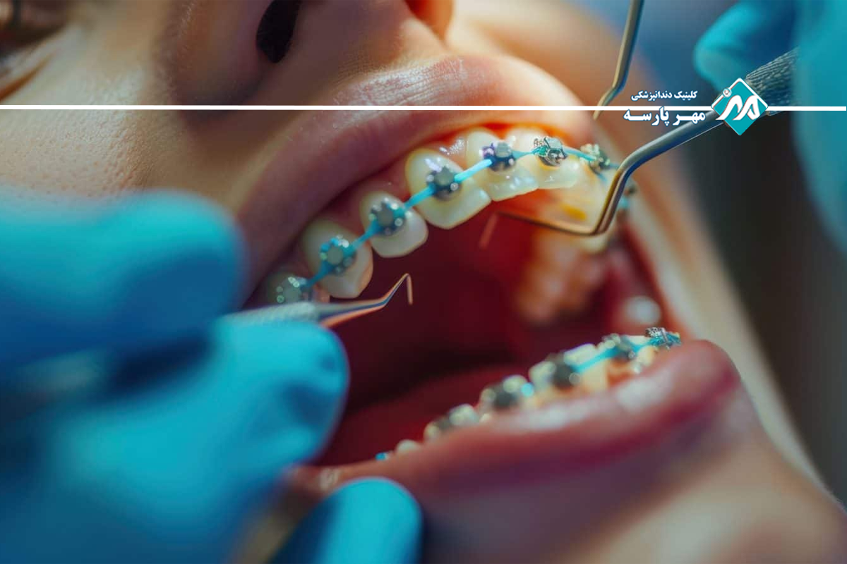 افراد  مناسب‌ انتخاب دیمون 