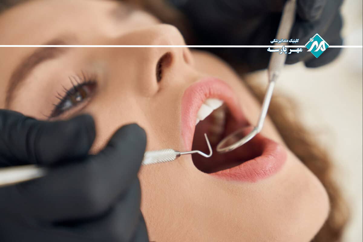 راه‌های پیشگیری از پوسیدگی دندان