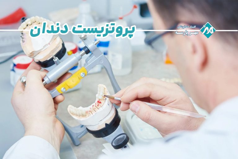 پروتزیست دندان