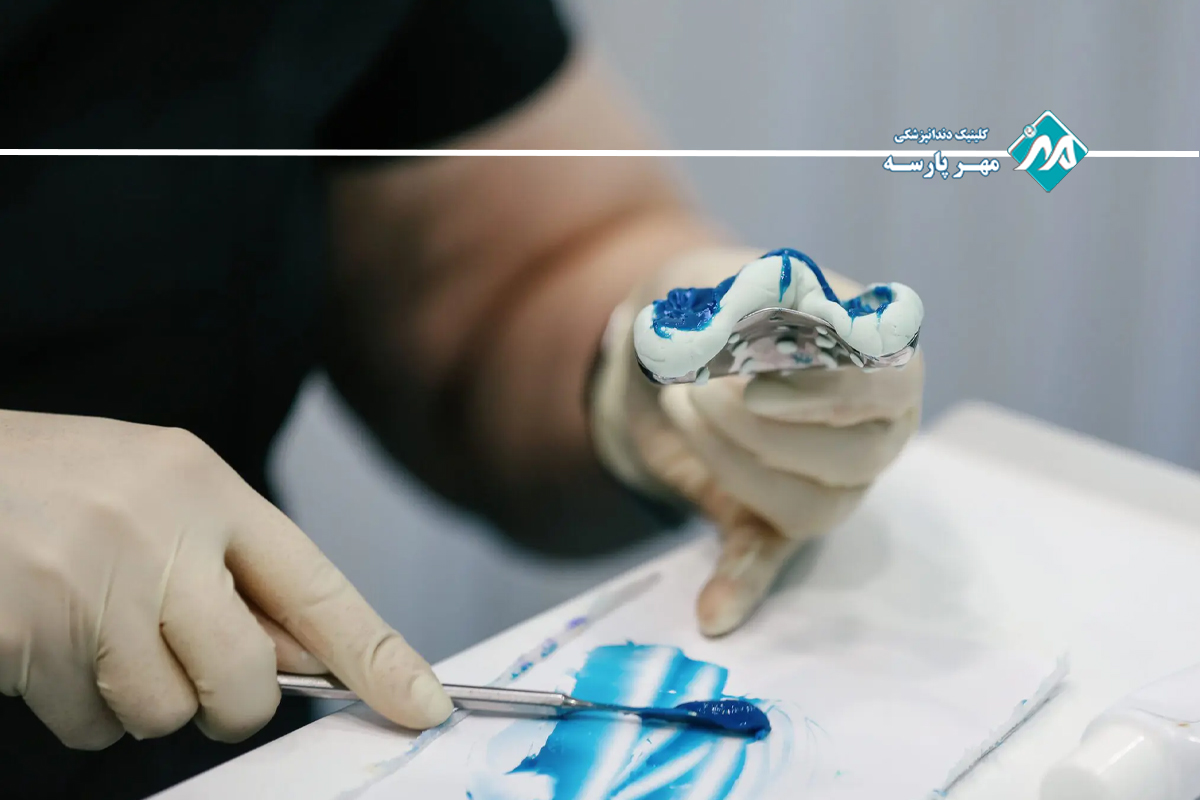 طراحی و ساخت پروتز دندان