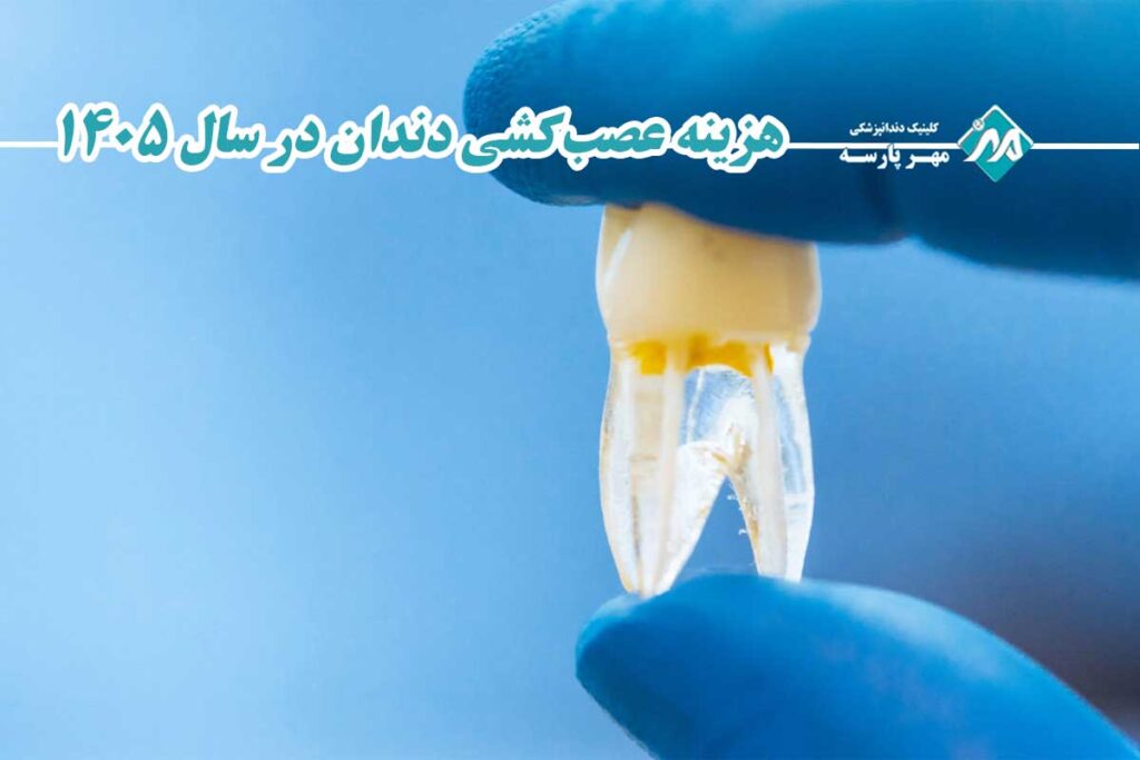 هزینه عصب‌کشی دندان در سال 1405