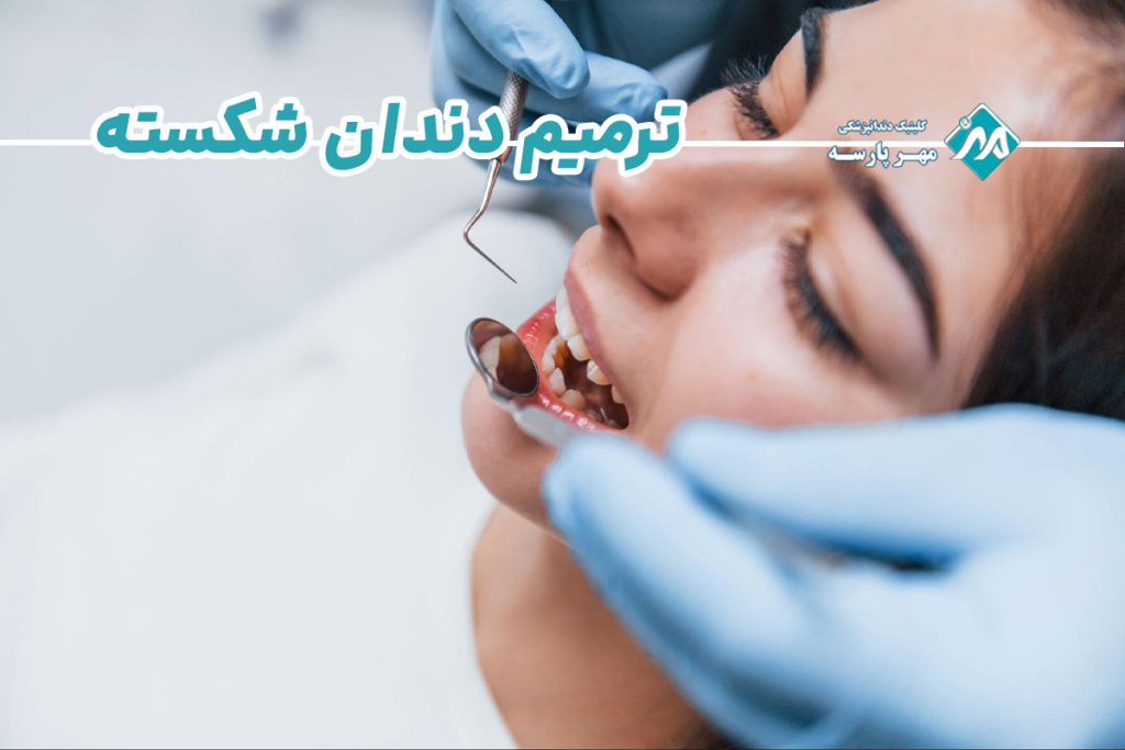 ترمیم دندان شکسته