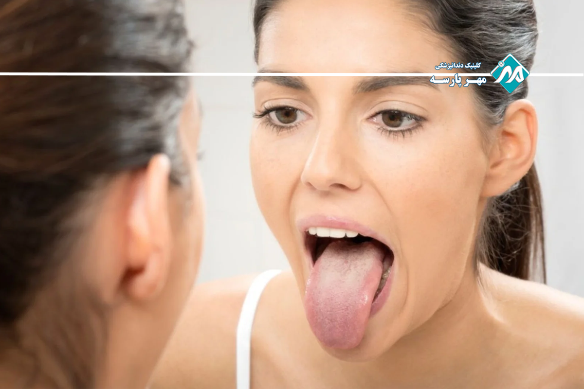 عوارض ناشی از خشکی دهان