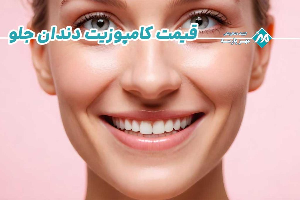 قیمت کامپوزیت دندان جلو