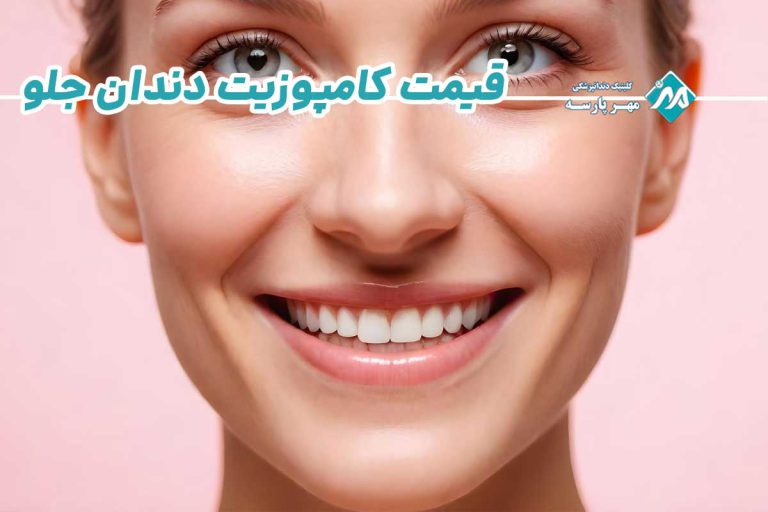 قیمت کامپوزیت دندان جلو