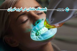 بلیچینگ دندان در غرب تهران
