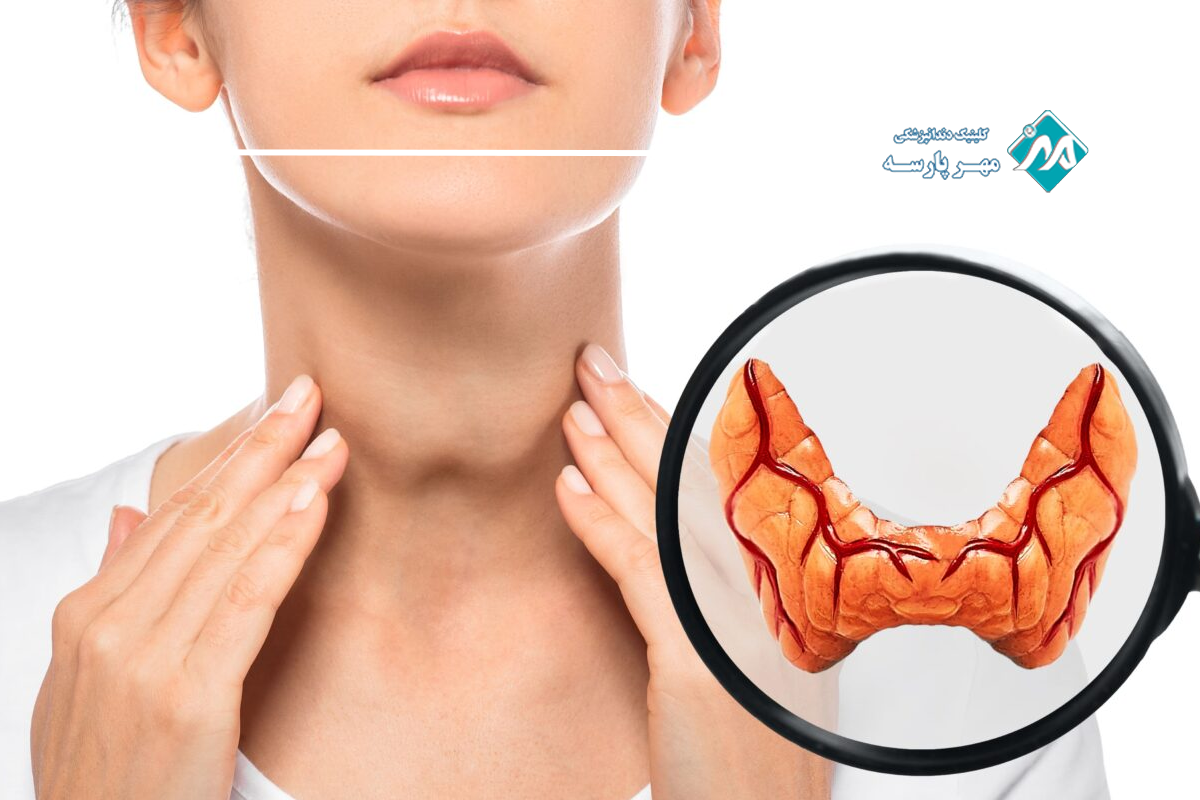 تاثیر تیروئید در خشکی دهان
