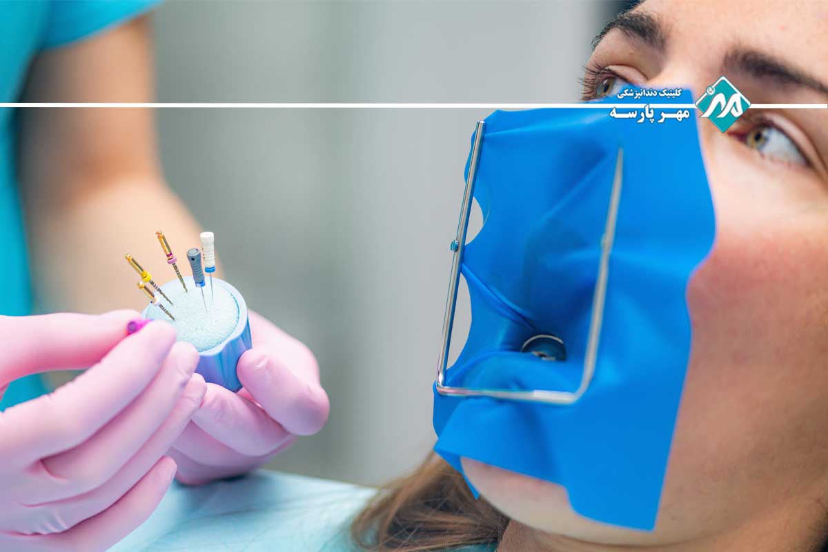مزایا و معایب عصبکشی دندان