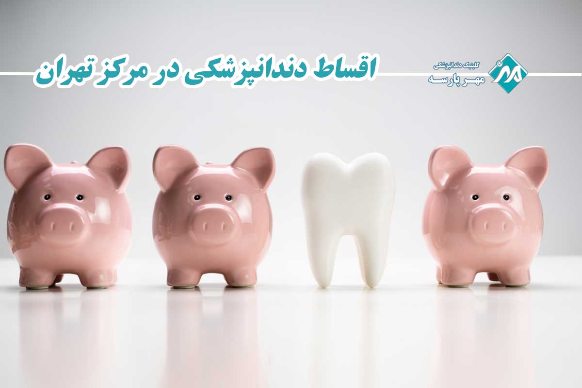 اقساط دندانپزشکی در مرکز تهران