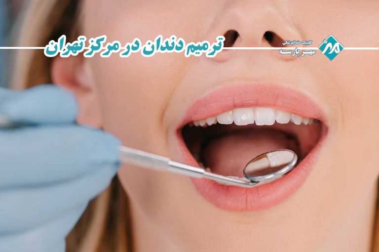 ترمیم دندان در مرکز تهران
