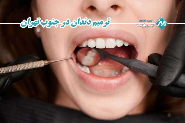 ترمیم دندان در جنوب تهران