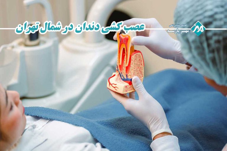 عصب کشی دندان در شمال تهران