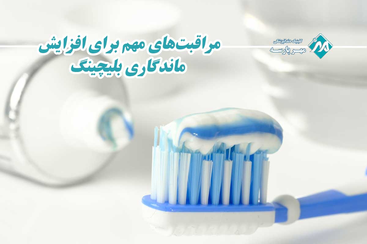 مراقبتهای مهم برای افزایش ماندگاری بلیچینگ