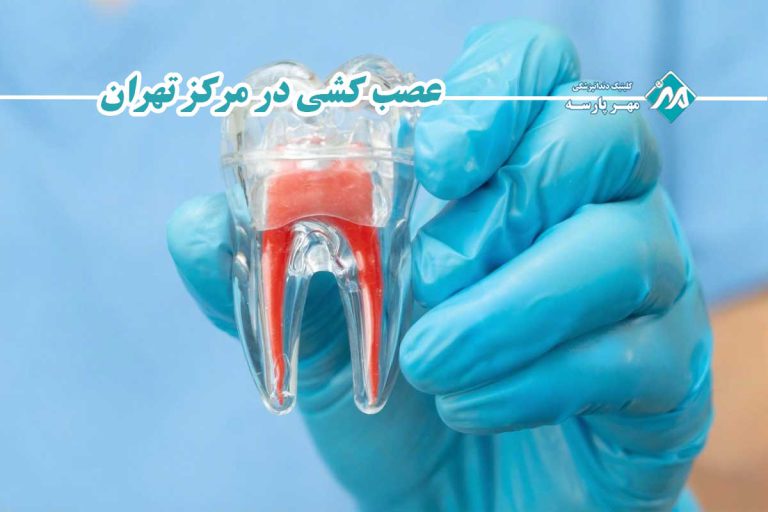عصب کشی در مرکز تهران