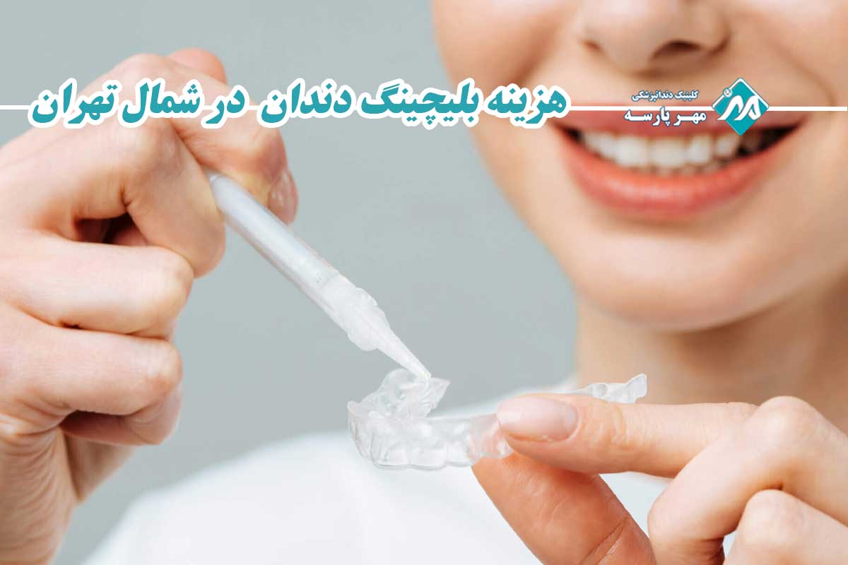 هزینه بلیچینگ دندان