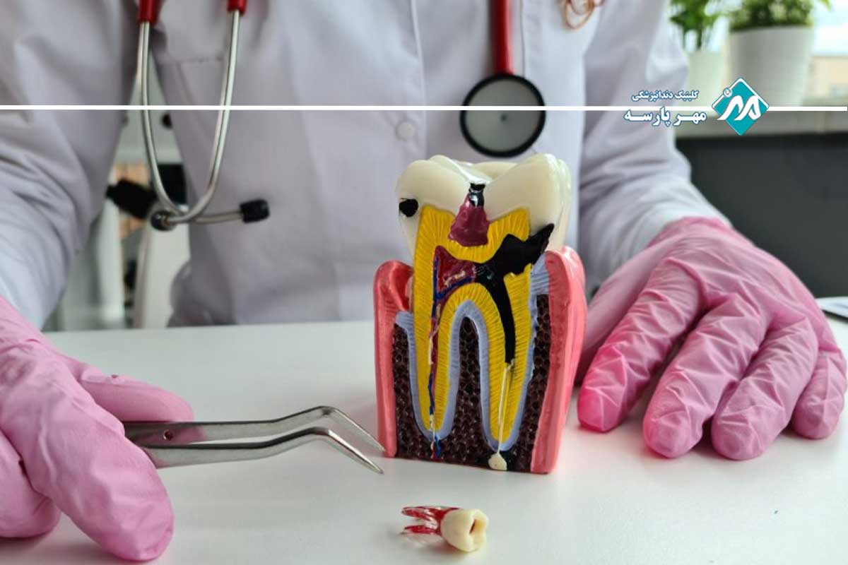 بهترین متخصص عصبکشی در جنوب تهران