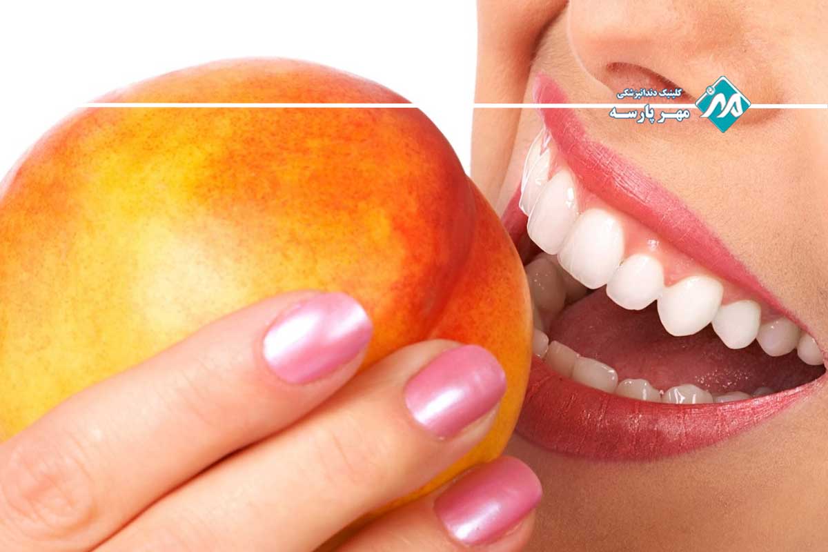 رژیم غذایی برای لمینت دندان