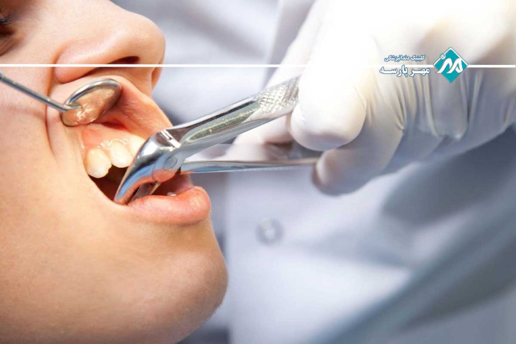 خدمات تحت پوشش عمومی بیمه دندانپزشکی معلم