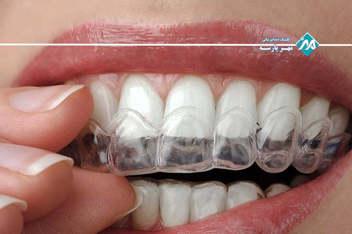 درمانهای تخصصی برای کاهش صدا دادن فک