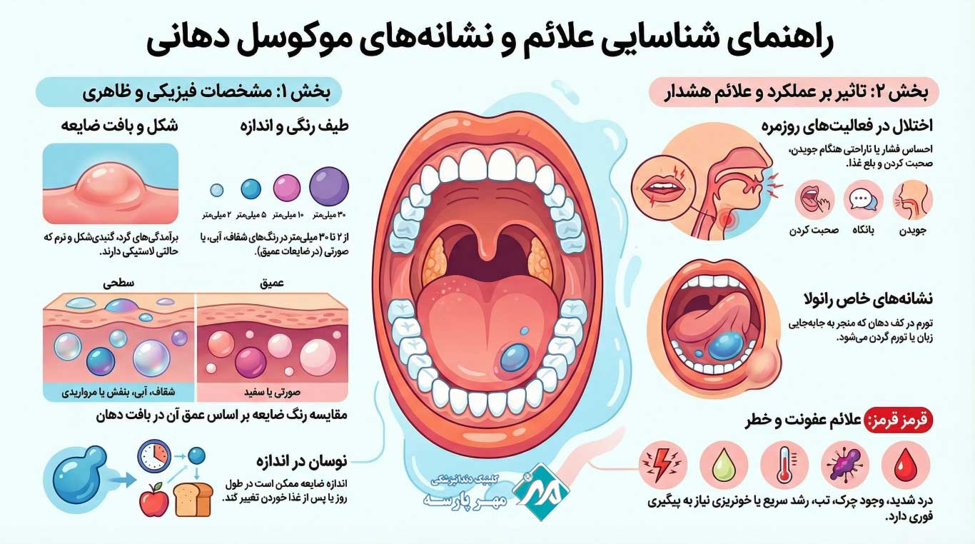 علائم و نشانه‌های بالینی موکوسل دهان