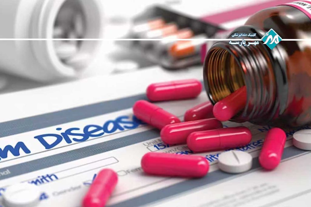 پریودنتیت دارویی