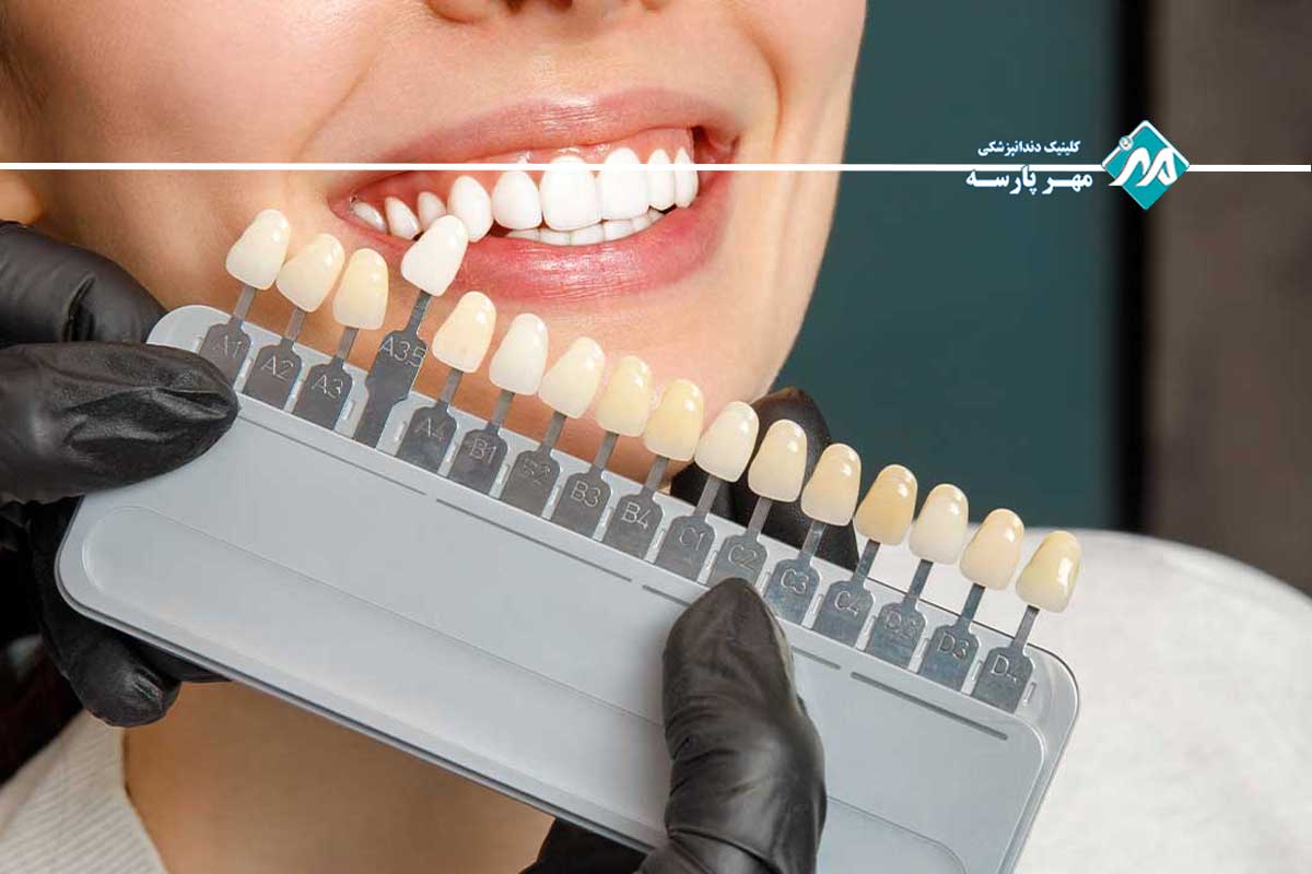 نحوه استفاده از خدمات بیمه دندانپزشکی کوثر