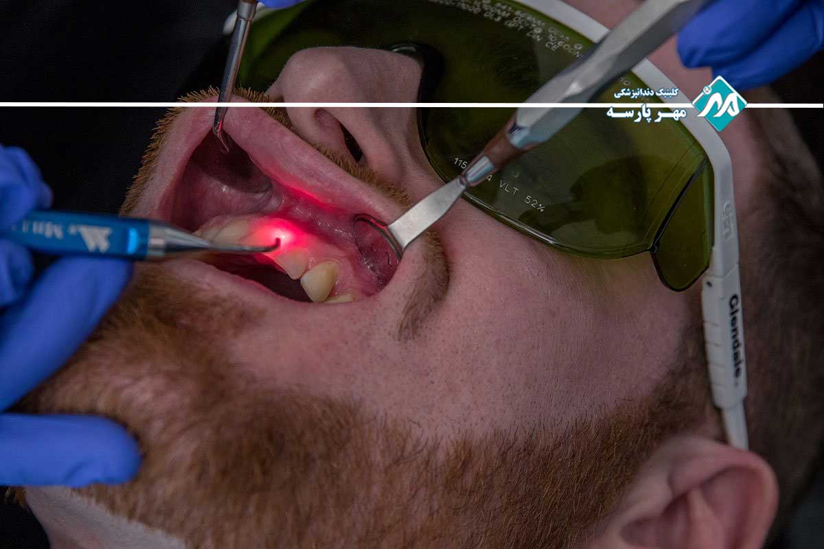 روش های درمان بیماری های لثه