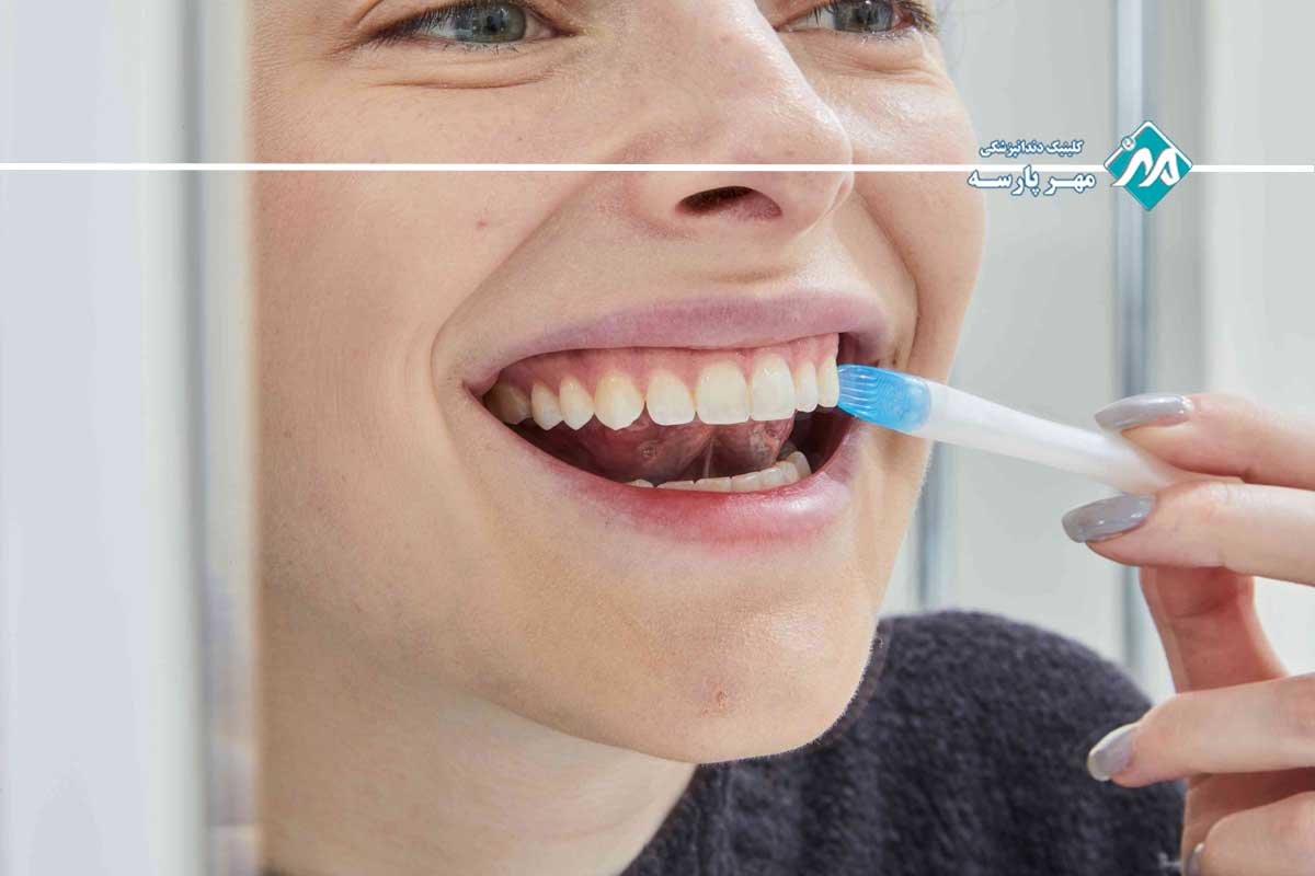 پیشگیری از آسیب دندانی ناشی از اسید معده