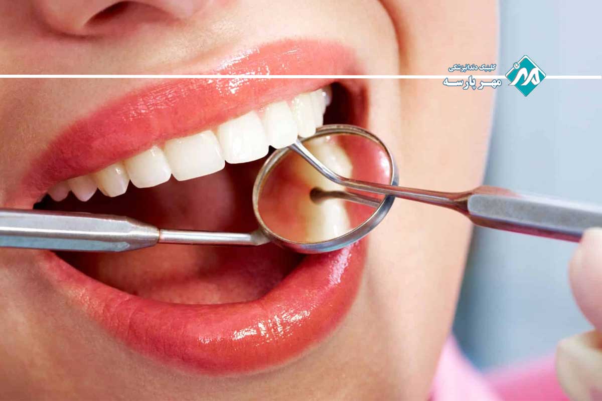 خدماتی تحت پوشش بیمه دندانپزشکی آسیا
