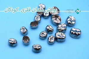 اهمیت روکش دندان برای کودکان