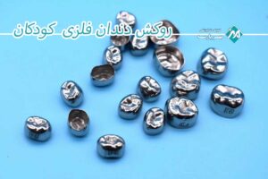 اهمیت روکش دندان برای کودکان